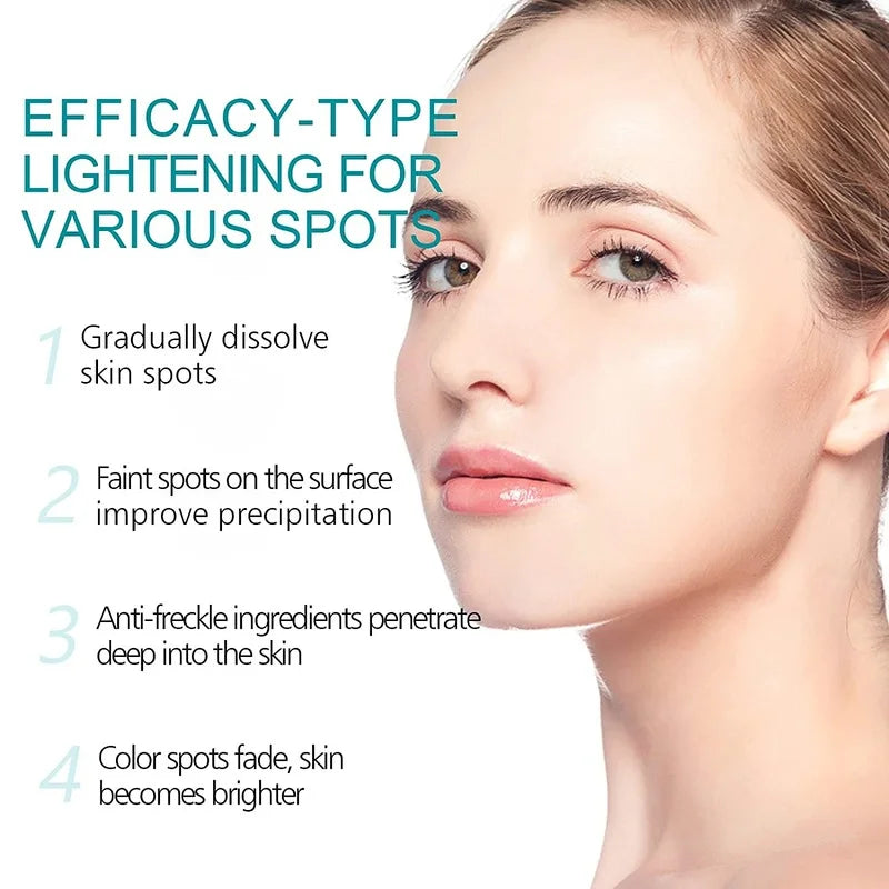 Freckle Whiten Cream Effective Removing Spot Eliminate Brown Stain Melasma Melanin Blemishes Lighten Moisturiser Face Skin Care