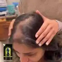 Anti Hair Loss Shampoo Deep Cleansing Dandruff Remover Improve Frizz Refreshing Oil Control Ginger Polygonum Multiflorum Shampoo