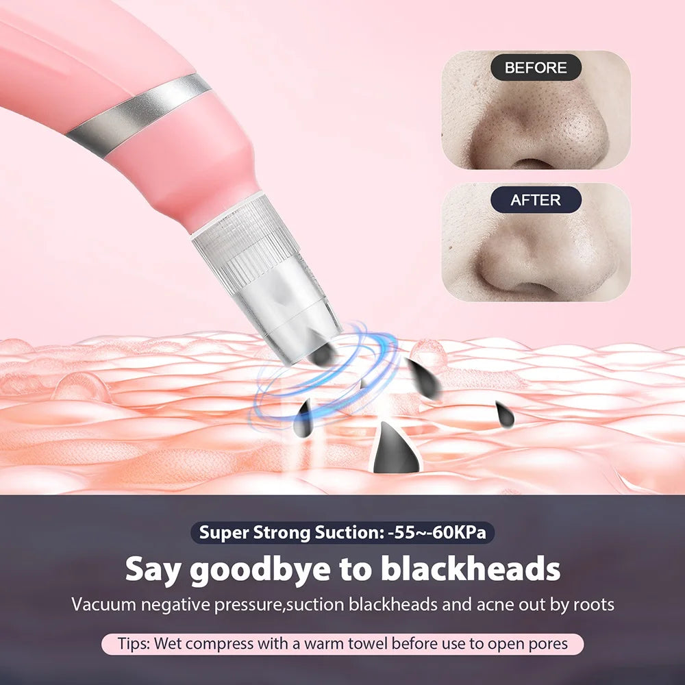 Foreverlily Portable Diamond Peeling Machine Microdermabrasion Facial Cleaning Device Exfoliation Vacuum Blackhead Remover