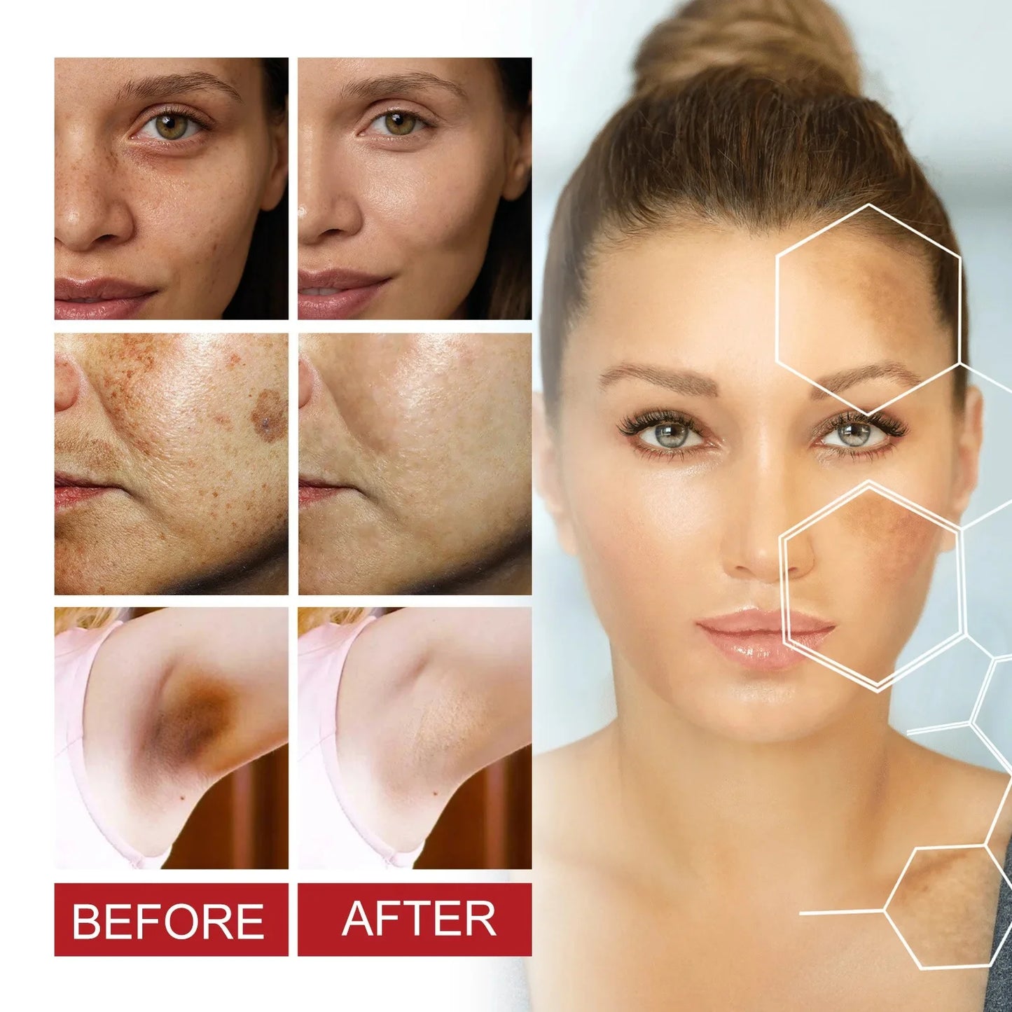 Freckle Whiten Cream Effective Removing Spot Eliminate Brown Stain Melasma Melanin Blemishes Lighten Moisturiser Face Skin Care