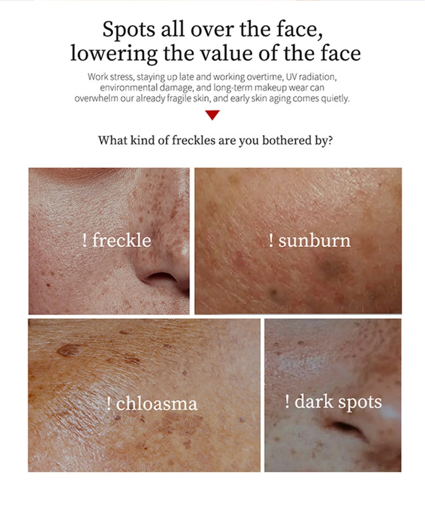 Freckle Whiten Cream Effective Removing Spot Eliminate Brown Stain Melasma Melanin Blemishes Lighten Moisturiser Face Skin Care