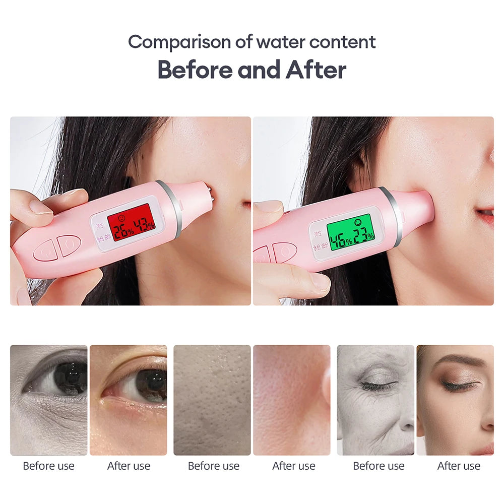 Oxygen Bubble Pen CO2 Oxygen Portable Facial Machine CO2 Gel Facial Skin Care Device Facial SPA CO2 Bubble Oxygen Beauty Machine