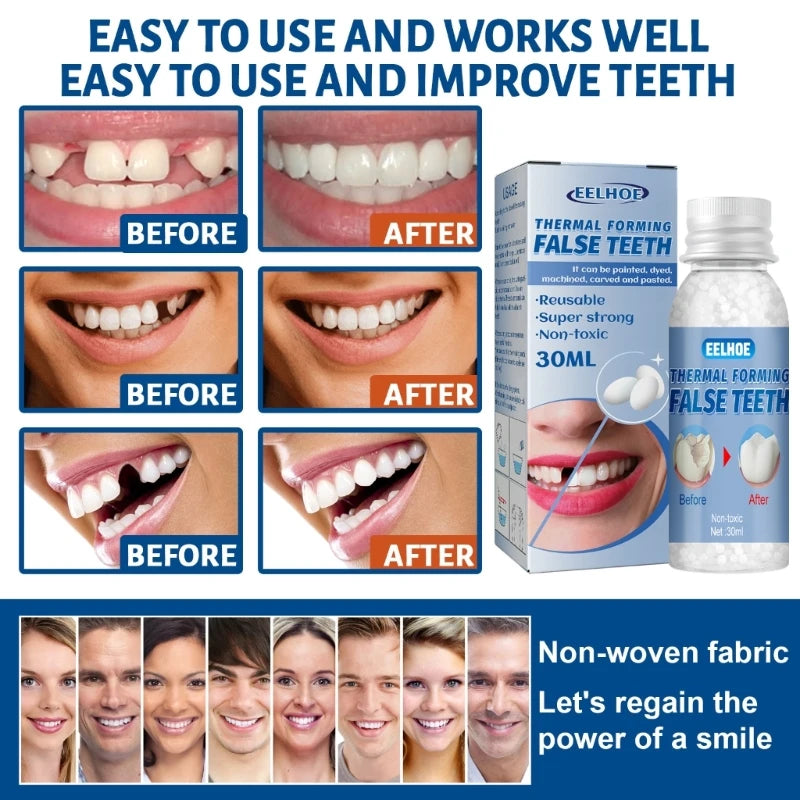 Resin False Teeth Solid Glue Temporary Tooth Repair Teeth Dentist 10/20/30ml