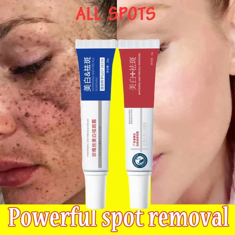 Freckle Whiten Cream Effective Removing Spot Eliminate Brown Stain Melasma Melanin Blemishes Lighten Moisturiser Face Skin Care