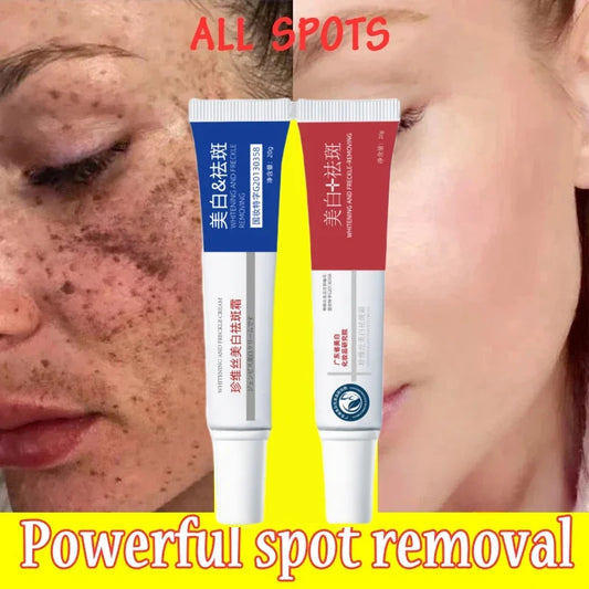 Freckle Whiten Cream Effective Removing Spot Eliminate Brown Stain Melasma Melanin Blemishes Lighten Moisturiser Face Skin Care