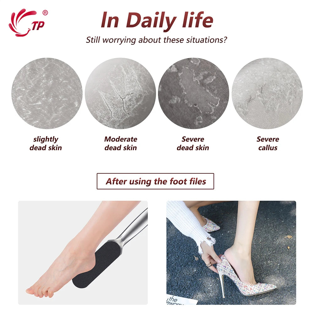 TP 20PCS Foot Rasp Profession Feet Care For Hard Dead Skin Callus Remover Pedicure File Replacement For Stainless Steel Handle