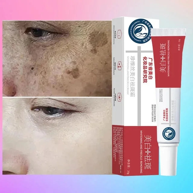 Freckle Whiten Cream Effective Removing Spot Eliminate Brown Stain Melasma Melanin Blemishes Lighten Moisturiser Face Skin Care